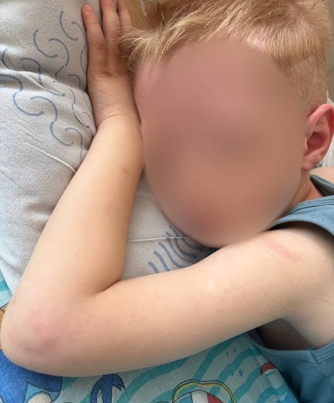 В&nbsp;Хабаровске ребёнка с&nbsp;аллергией госпитализировали после&nbsp;обеда в&nbsp;детсаду